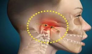 Temporomandibular Joint -TMJ