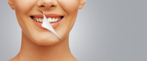 Tooth Extraction
