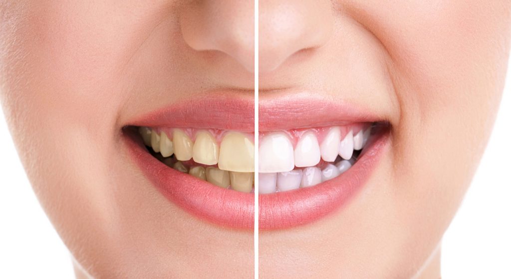 Cosmetic Dentistry