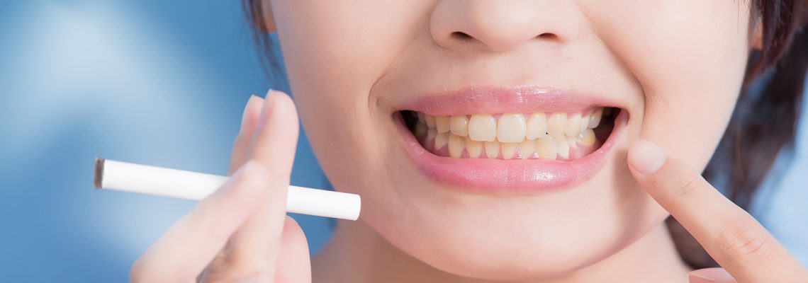 5 Harmful Ways Smoking Can Affect Your Mouth!