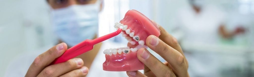 4 Reasons You May be Clenching Your Teeth! - 4Smile