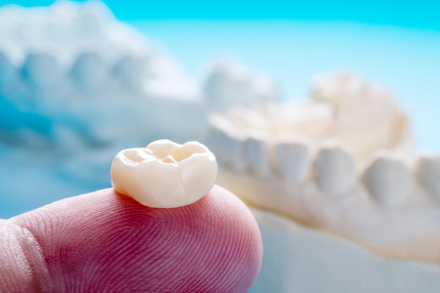 Wisdom Tooth Removal