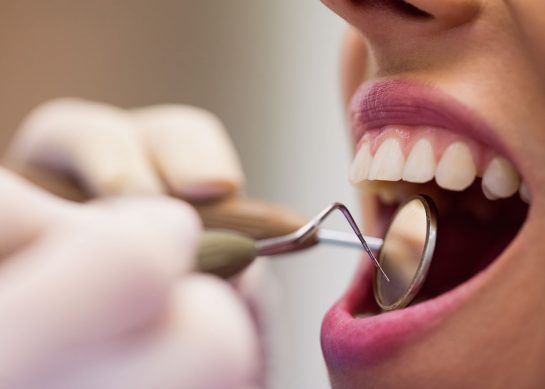 Tooth scaling : Do you need it?